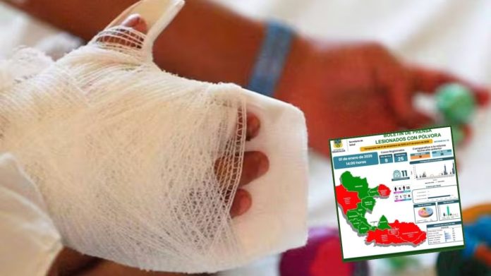 Risaralda cerró el año con 25 personas lesionadas por pólvora, entre ellas un menor de 11 años