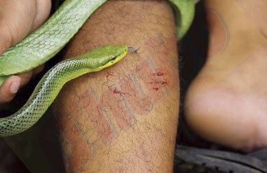 Serpiente mordió a una niña de 2 años 